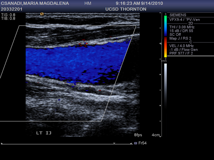 Mami’s Follow-up Blood Clot Ultrasound – PAC's Worlds